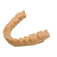 Title High Strength Dental Model Resin Low Viscosity 3D Printing Material for Implants & Orthodontics Fast Curing