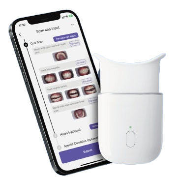 AI-Powered Wireless Scan-Box for Intraoral Imaging 1-Minute Scan & 5-Sec Report Generation Compatible with PC and Mobile Devices