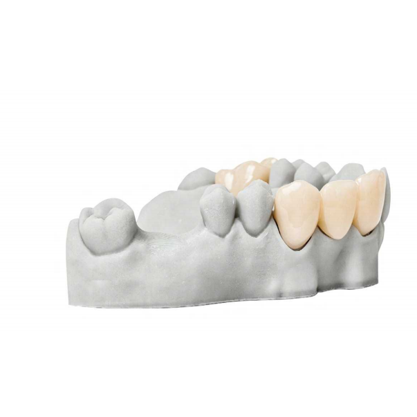 Dental 3D Printing Resin for Temporary Crowns & Bridges, High-Strength Photopolymer Material with Natural Aesthetics & Abrasion Resistance