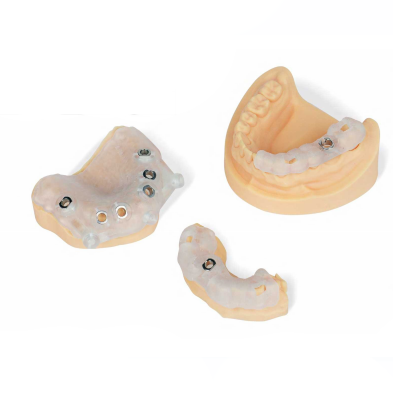 Dental Surgical Guide 3D Printing Resin, Biocompatible Clear Photopolymer for Implant Guides, Autoclavable & High Precision Material