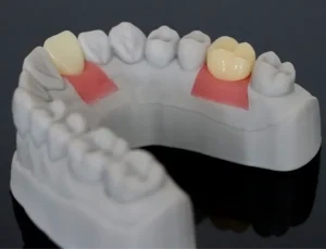 Dental Gingiva Mask Photopolymer Resin High Flexibility Tear Resistant Pink 3D Printing Material Low Irritation