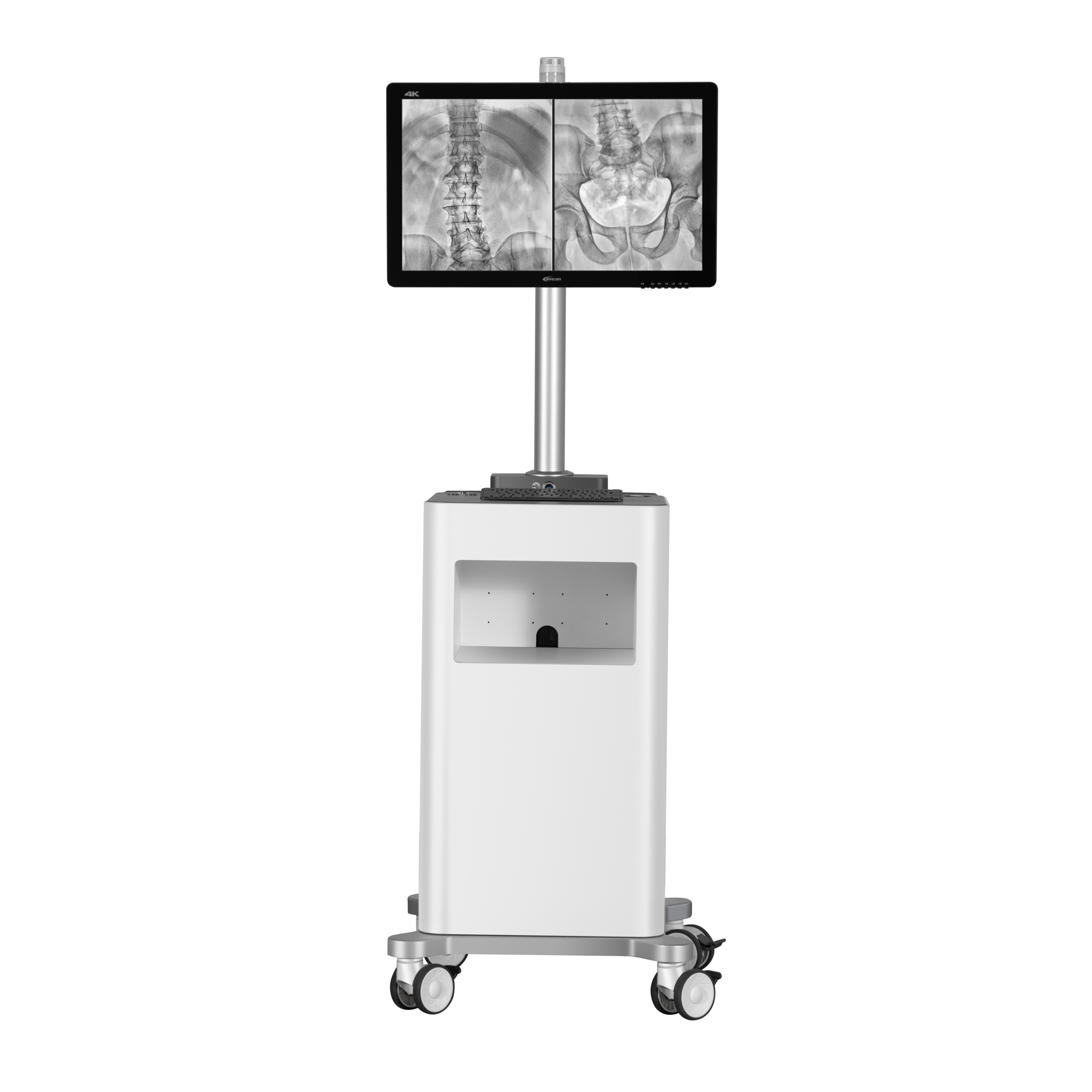 Mobile C-Arm X-ray Machine Liangjian-Ⅱ