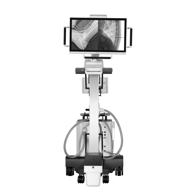 Mobile C-Arm X-ray Machine Mingjian-Ⅱ