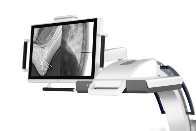 Mobile C-Arm X-ray Machine Mingjian-Ⅱ