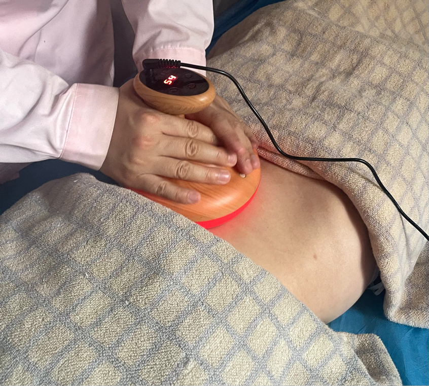 Fuyang Red-Light Three-Star Moxibustion,MY SHOP,Fuyang Red-Light Three-Star Moxibustion