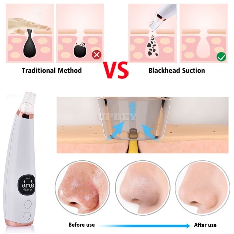 Blackhead Remover Facial Cleaner E16 Deep Pore Acne Pimple Removal Vacuum Suction