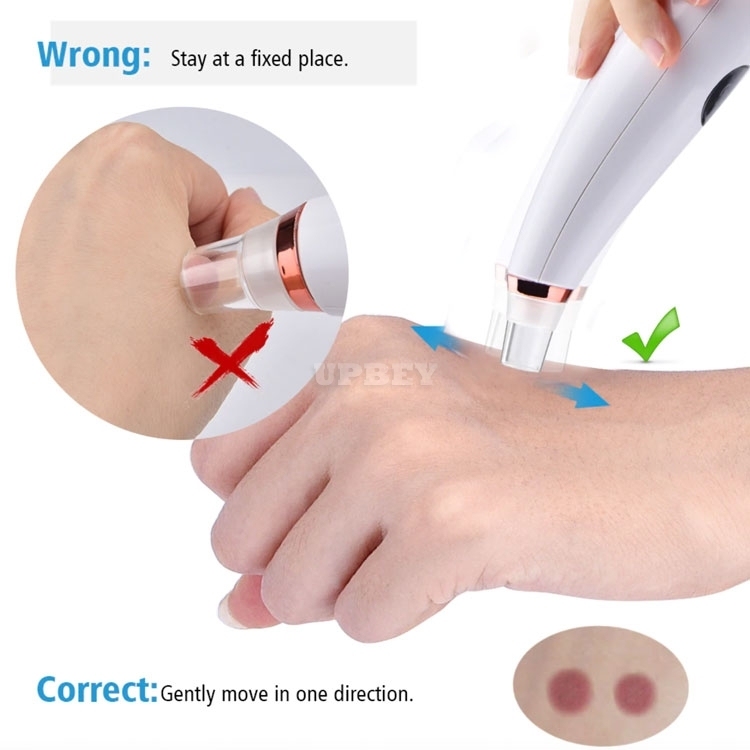 Blackhead Remover Facial Cleaner E16 Deep Pore Acne Pimple Removal Vacuum Suction