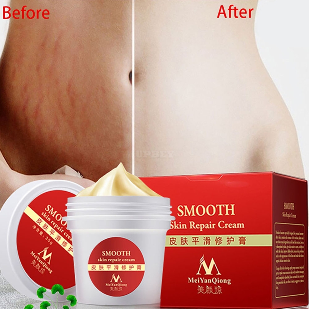 Smooth Skin Repair Cream for Stretch Marks Scar Removal Skin Repair Body Cream