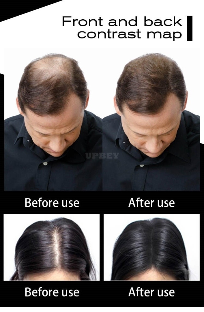 Beauty Cosmetic Plants Hair Fibers Spray Powder Hair Growth Treatment Fibers 25g black