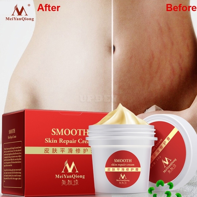 Smooth Skin Repair Cream for Stretch Marks Scar Removal Skin Repair Body Cream