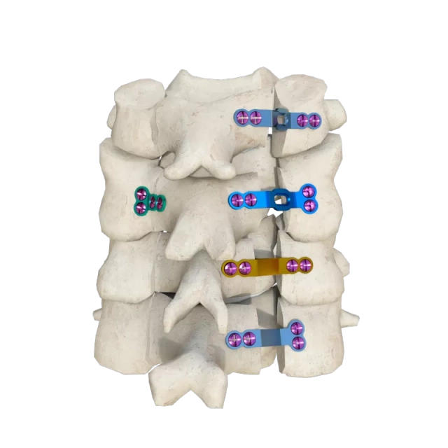 Hinged Titanium Laminoplasty Plate System,Shinvaunited,Hinged Titanium Laminoplasty Plate System
