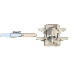 Lumbar Interbody Fusion Cage(Insert-Type),Shinvaunited,Lumbar Interbody Fusion Cage(Insert-Type)