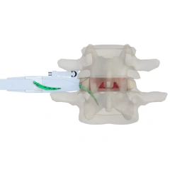 Lumbar Interbody Fusion Cage(Insert-Type),Shinvaunited,Lumbar Interbody Fusion Cage(Insert-Type)