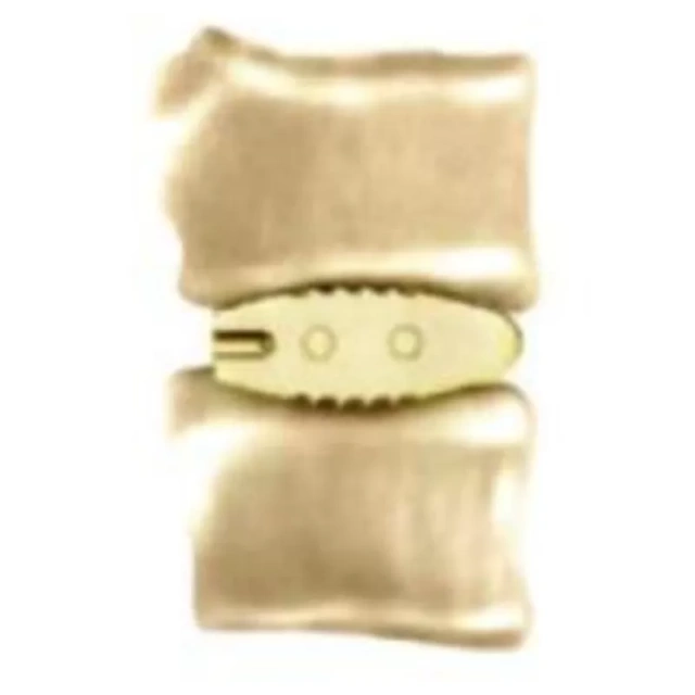 Lumbar Interbody Fusion Cage LF-I,Shinvaunited,Lumbar Interbody Fusion Cage LF-I
