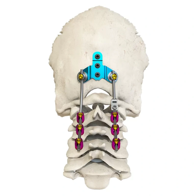 Posterior occipital-cervical-thoracic spinal system,Shinvaunited,Posterior occipital-cervical-thoracic spinal system