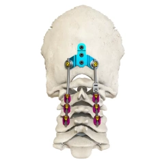 Posterior occipital-cervical-thoracic spinal system,Shinvaunited,Posterior occipital-cervical-thoracic spinal system