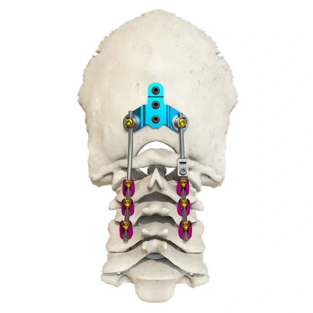 Posterior occipital-cervical-thoracic spinal system,Shinvaunited,Posterior occipital-cervical-thoracic spinal system