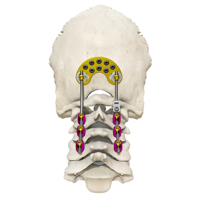 Posterior occipital-cervical-thoracic spinal system,Shinvaunited,Posterior occipital-cervical-thoracic spinal system