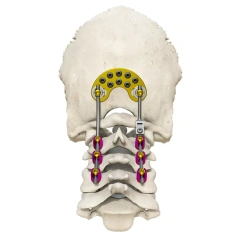 Posterior occipital-cervical-thoracic spinal system,Shinvaunited,Posterior occipital-cervical-thoracic spinal system