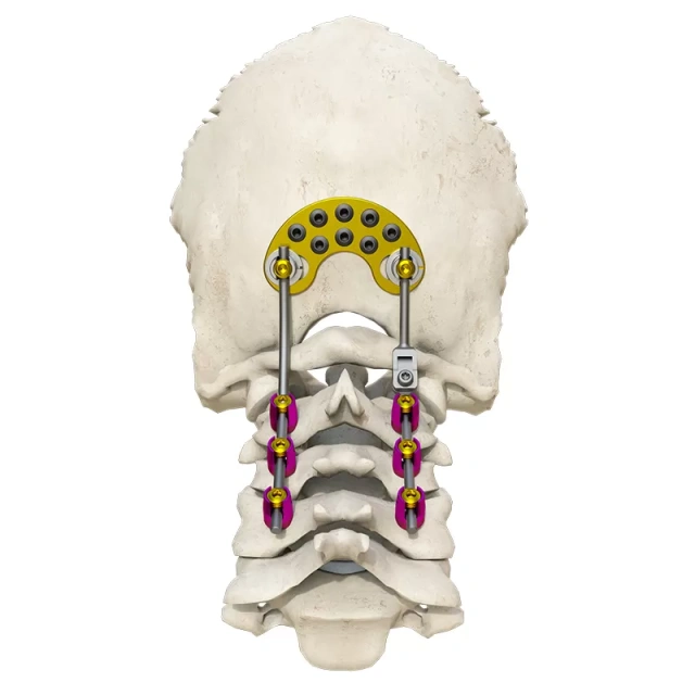 Posterior occipital-cervical-thoracic spinal system,Shinvaunited,Posterior occipital-cervical-thoracic spinal system