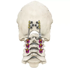 Posterior occipital-cervical-thoracic spinal system,Shinvaunited,Posterior occipital-cervical-thoracic spinal system