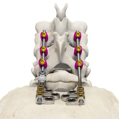 Posterior occipital-cervical-thoracic spinal system,Shinvaunited,Posterior occipital-cervical-thoracic spinal system