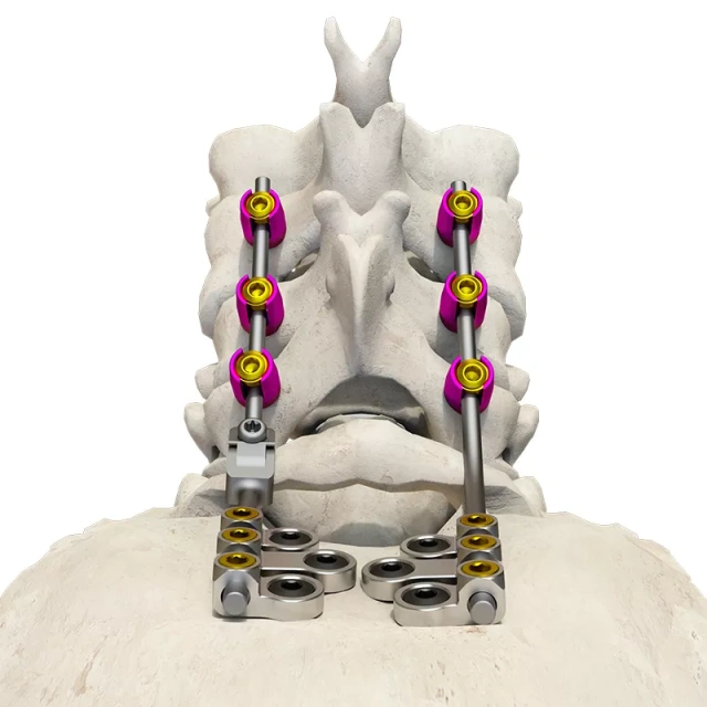Posterior occipital-cervical-thoracic spinal system,Shinvaunited,Posterior occipital-cervical-thoracic spinal system