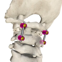 Posterior occipital-cervical-thoracic spinal system,Shinvaunited,Posterior occipital-cervical-thoracic spinal system
