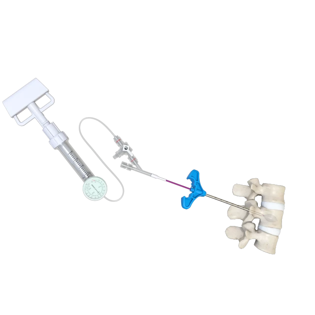 Balloon Kyphoplasty (PKP),Shinvaunited,Balloon Kyphoplasty (PKP)