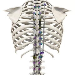 CoCrMo Posterior Thoracolumbar Spinal System 4.5(for children),Shinvaunited,CoCrMo Posterior Thoracolumbar Spinal System 4.5(for children)