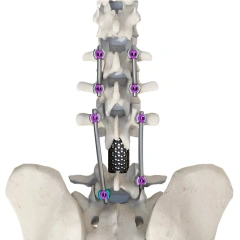 CoCrMo Posterior Thoracolumbar Spinal System 4.5(for children),Shinvaunited,CoCrMo Posterior Thoracolumbar Spinal System 4.5(for children)