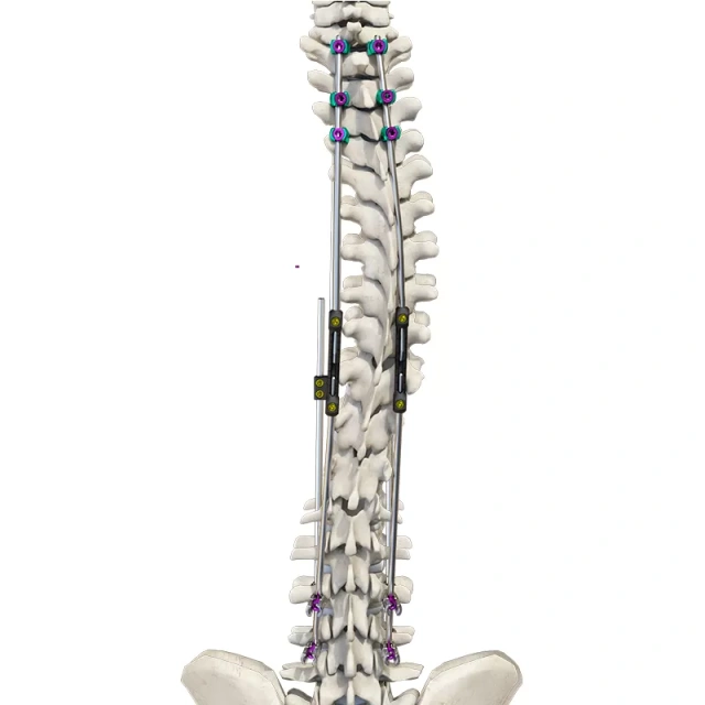 CoCrMo Posterior Thoracolumbar Spinal System 4.5(for children),Shinvaunited,CoCrMo Posterior Thoracolumbar Spinal System 4.5(for children)