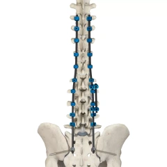 CoCrMo Thoracolumbar Posterior Pedicle Screw and Rod System 4.75,Shinvaunited,CoCrMo Thoracolumbar Posterior Pedicle Screw and Rod System 4.75
