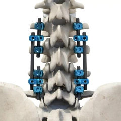 CoCrMo Thoracolumbar Posterior Pedicle Screw and Rod System 4.75,Shinvaunited,CoCrMo Thoracolumbar Posterior Pedicle Screw and Rod System 4.75