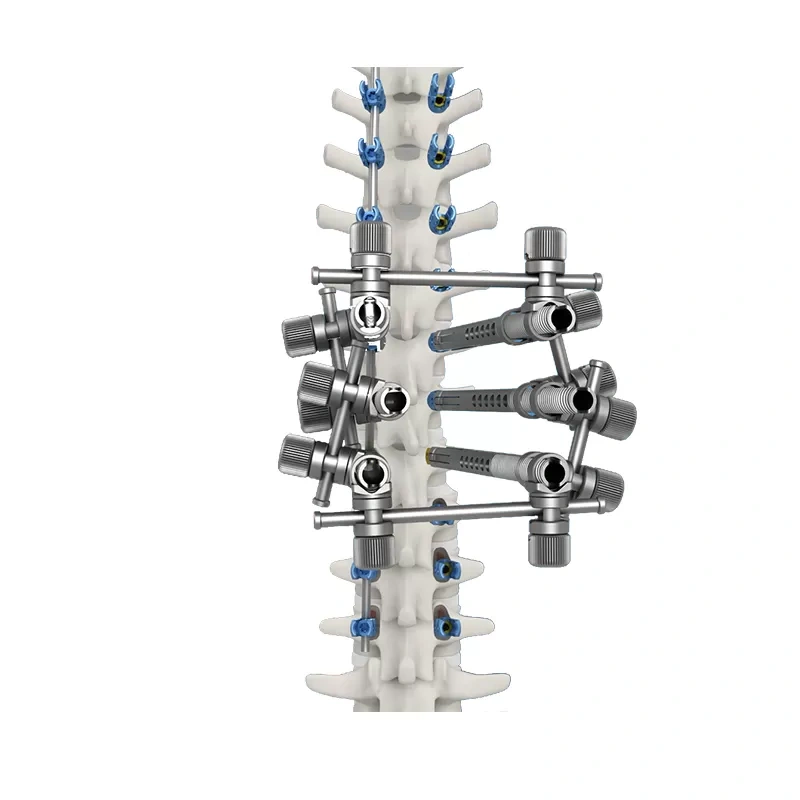 CoCrMo Thoracolumbar Posterior Pedicle Screw and Rod System 4.75,Shinvaunited,CoCrMo Thoracolumbar Posterior Pedicle Screw and Rod System 4.75