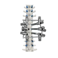 CoCrMo Thoracolumbar Posterior Pedicle Screw and Rod System 5.5/6.0,Shinvaunited,CoCrMo Thoracolumbar Posterior Pedicle Screw and Rod System 5.5/6.0