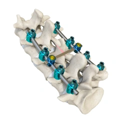 Luna Posterior Thoracolumbar Spinal System,Shinvaunited,Luna Posterior Thoracolumbar Spinal System
