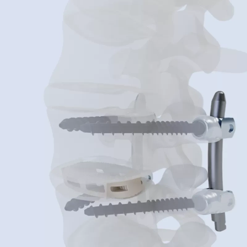 Oblique Lateral Interbody Fusion Cage LF-IV,Shinvaunited,Oblique Lateral Interbody Fusion Cage LF-IV