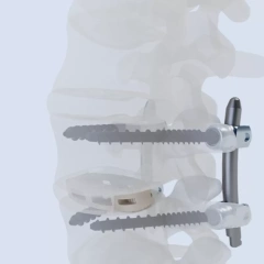 Oblique Lateral Interbody Fusion Cage LF-IV,Shinvaunited,Oblique Lateral Interbody Fusion Cage LF-IV