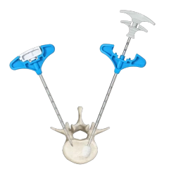 Percutaneous Vertebroplasty (PVP),Shinvaunited,Percutaneous Vertebroplasty (PVP)