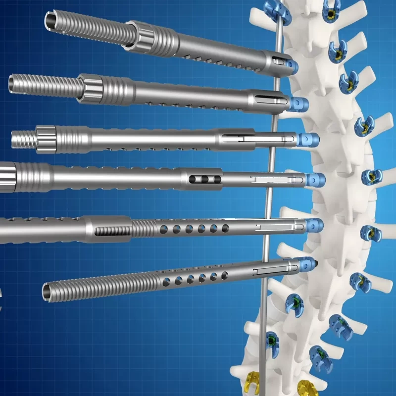 Ti Posterior Rod-Screw for Spinal Deformity (5.5 System),Shinvaunited,Ti Posterior Rod-Screw for Spinal Deformity (5.5 System)
