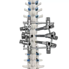 Ti Posterior Rod-Screw for Spinal Deformity (5.5 System),Shinvaunited,Ti Posterior Rod-Screw for Spinal Deformity (5.5 System)