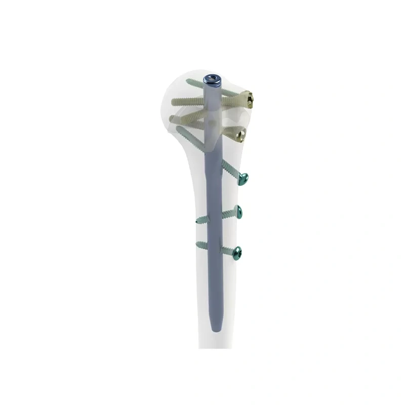 Humeral Intramedullary Nail,Shinvaunited,Humeral Intramedullary Nail
