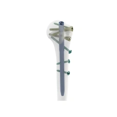 Humeral Intramedullary Nail,Shinvaunited,Humeral Intramedullary Nail