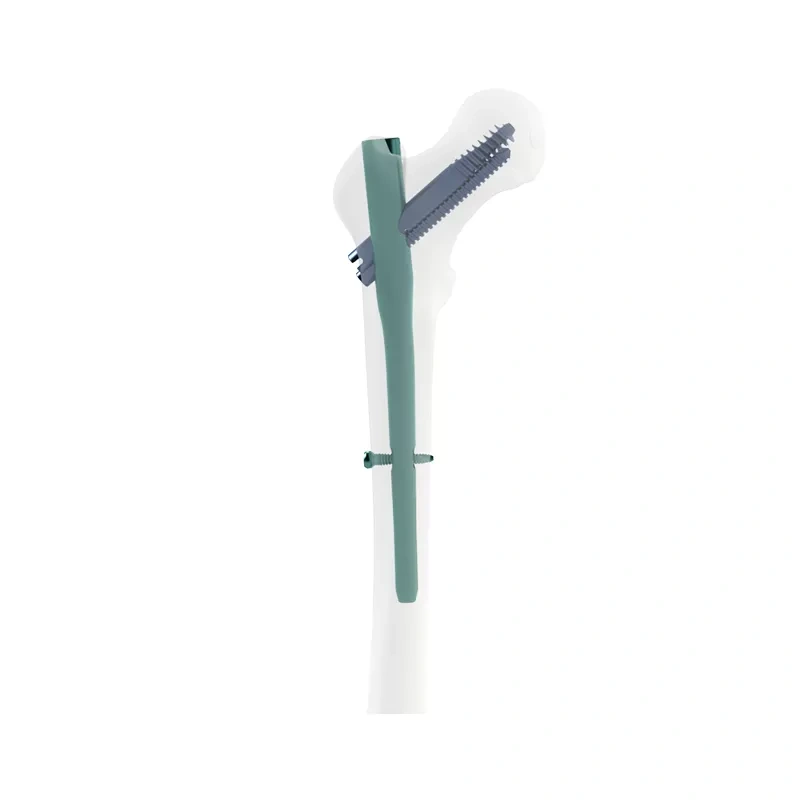 Proximal Femoral Nail Type II – Double Lag Screw,Shinvaunited,Proximal Femoral Nail Type II – Double Lag Screw