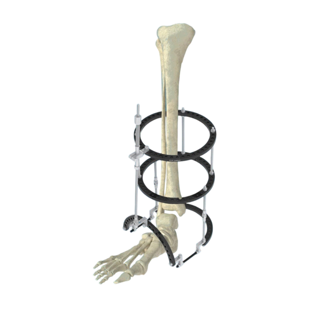 Ring-Type Multi-Function External Fixator,Shinvaunited,Ring-Type Multi-Function External Fixator