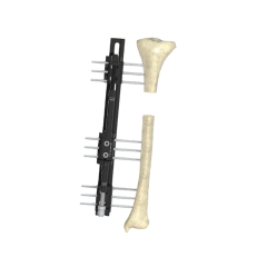 R-Type Combination External Fixator,Shinvaunited,R-Type Combination External Fixator
