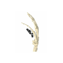 Mini External Fixator,Shinvaunited,Mini External Fixator