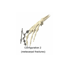 Phalanx External Fixator,Shinvaunited,Phalanx External Fixator