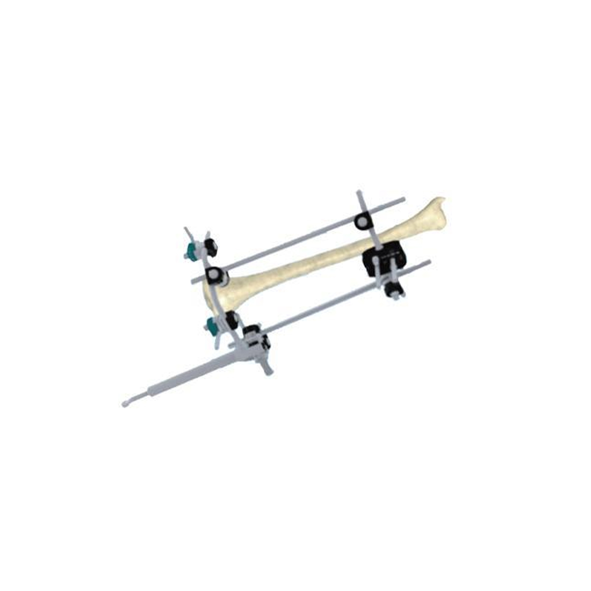 Q-Type Combination External Fixator,Shinvaunited,Q-Type Combination External Fixator